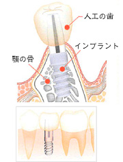 ttl-06-img04.jpg